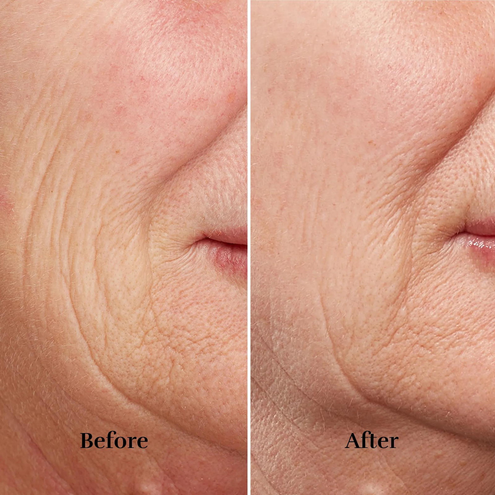 Silkn FaceTite Revive FTC1PE1001