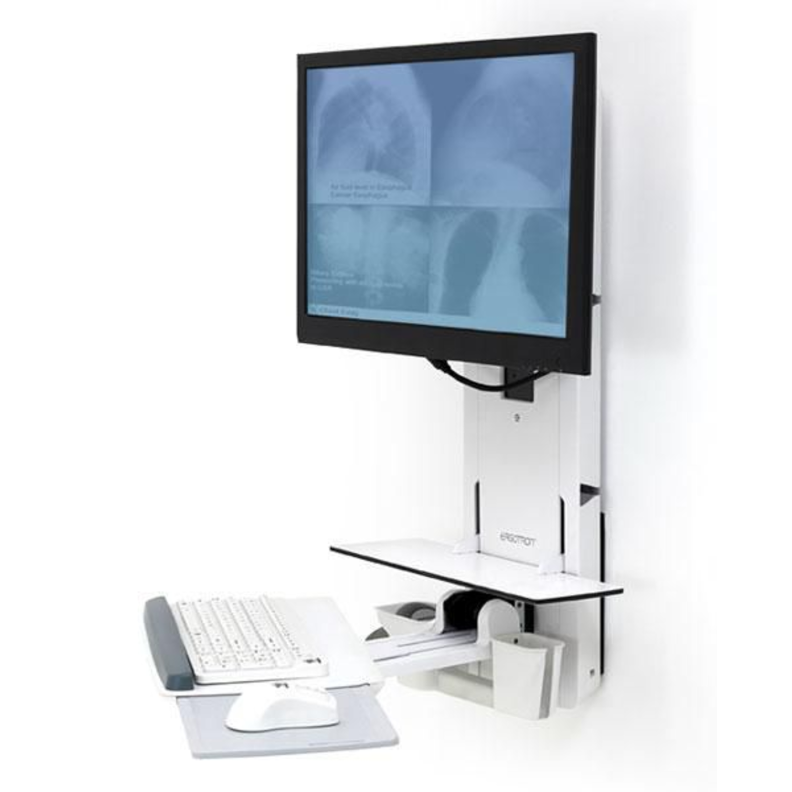 Ergotron PATIENT ROOM VL18 STS WM BRIGHT WHITE Lt24inch -14.9kg