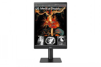 LG 21.3 3MP IPS DIAGNOSTIC MONITOR
